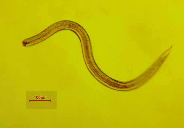 Представитель Семейства Sphaerolaimidae
